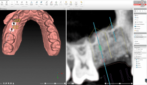 Computer aided treatment plan images