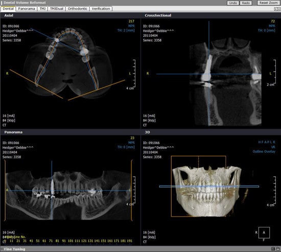3D images from a CT scanner