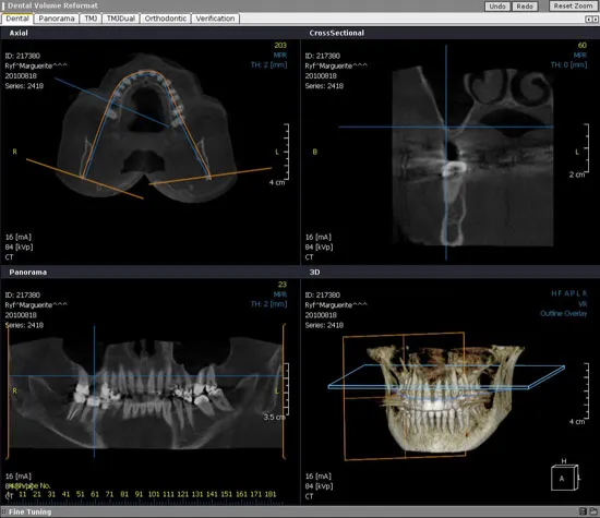 3D images from a CT scanner