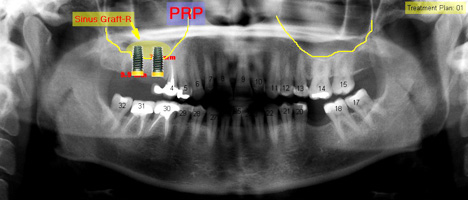 Computer aided treatment plan images